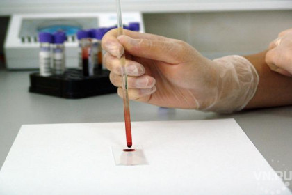 Бесплатный тест на ВИЧ смогут пройти жители областного центра