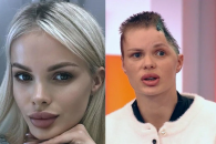 Российская модель потеряла часть черепа после избиения