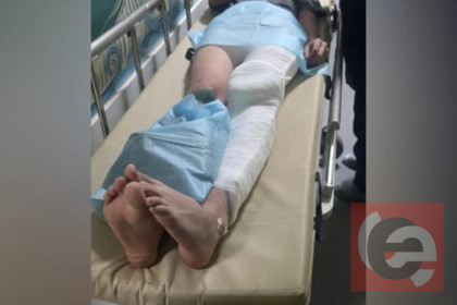 Юный питбайкер попал в больницу после нападения мужчин в Новосибирске