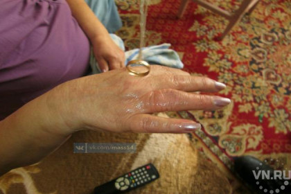 Спасатели сняли обручальное кольцо с отекшего пальца 68-летней сибирячки