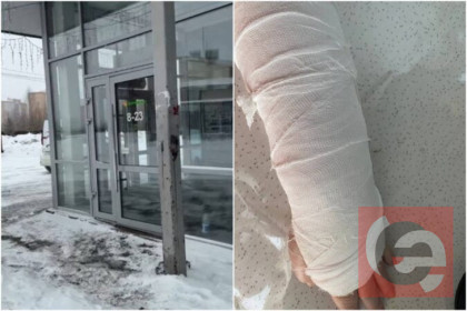 Жительница Новосибирска обвинила «Марию-Ра» в переломе руки