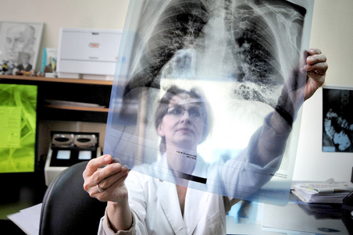 15 человек заболели и двое умерли от туберкулеза в Болотном