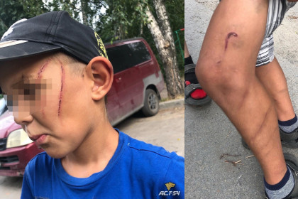 Новосибирец жестоко избил 7-летнего пасынка шнуром от чайника 