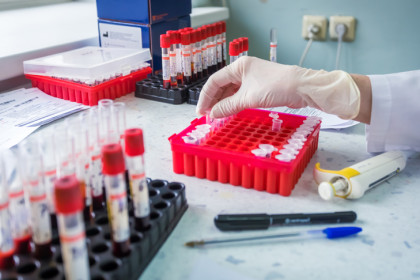 Минздрав Новосибирской области опроверг дефицит препаратов для диабетиков