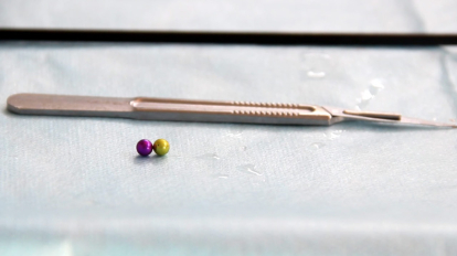 В Кузбассе годовалая девочка проглотила 24 магнитных шарика