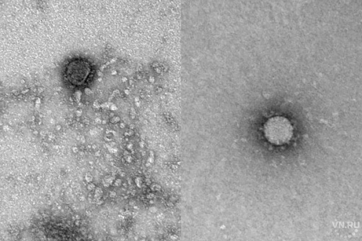 Фото коронавируса-2020 получили новосибирские ученые