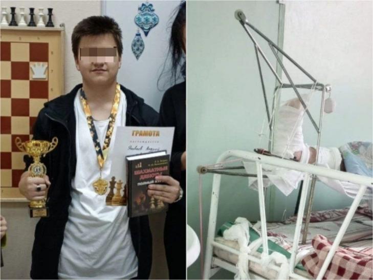 Тройной перелом получил подросток-шахматист после похода в магазин в Новосибирске