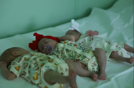 В Новосибирске родилась тройня — у каждого своя плацента