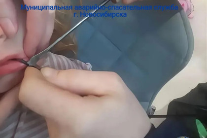 В Новосибирске ребенку спицами зонта защемило язык