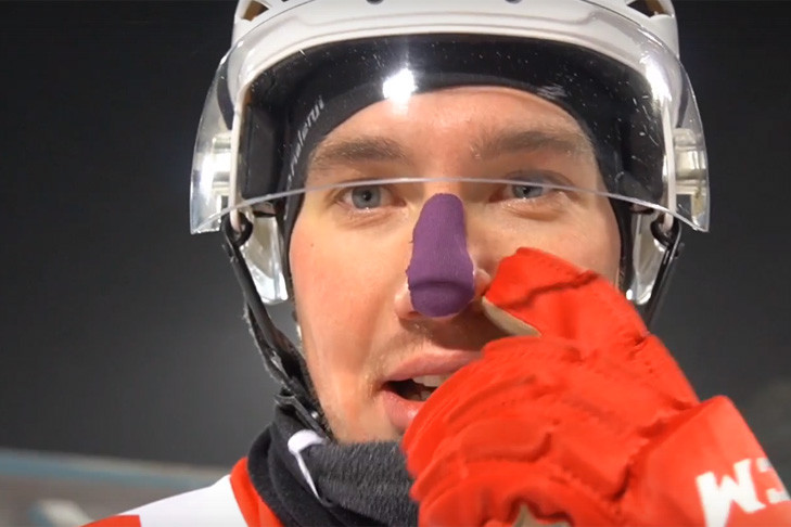 Хоккеист Попеляев отморозил нос во время матча в Новосибирске