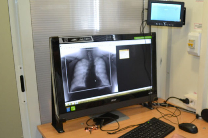 Пять случаев туберкулеза выявлено в Доволенском районе в 2019 году