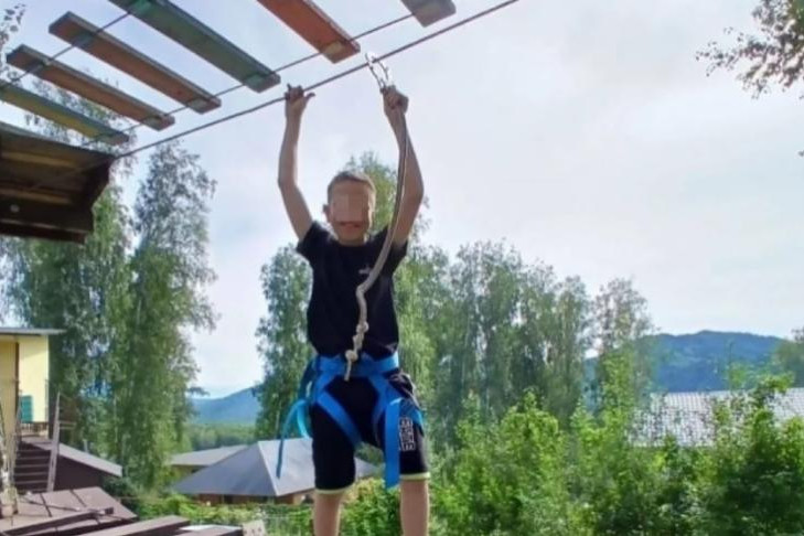 Пластические хирурги вернули лицо жертве отчима из Прокопьевска