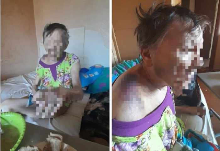 Пенсионерка попала в больницу после избиения сыном в Октябрьском районе 