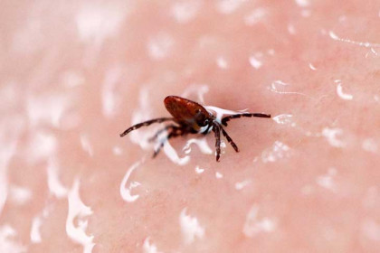 Как снять клеща – советы новосибирцам на майские праздники-2023