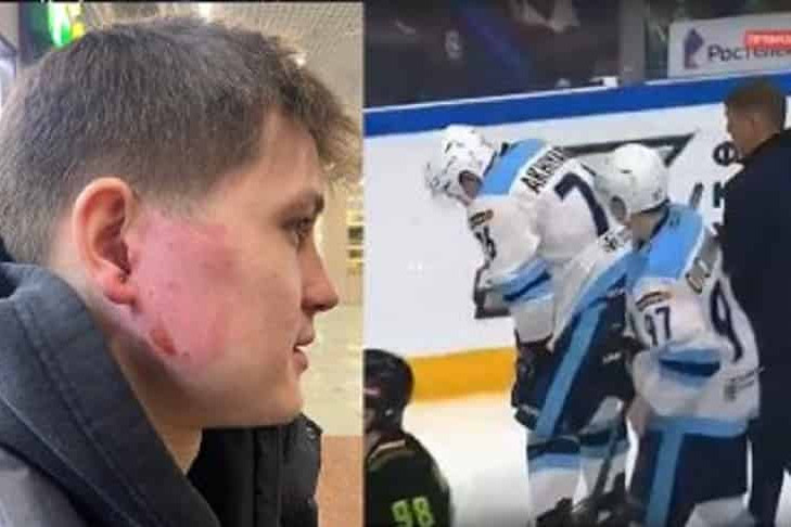 Шайба попала в ухо 23-летнему защитнику ХК «Сибирь» Тимуру Ахиярову