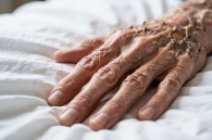 Пенсионерку в пансионате Новосибирска довели до истощения