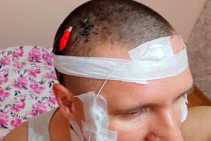 Экспериментатор из Новосибирска вживил себе чип в мозг при помощи дрели