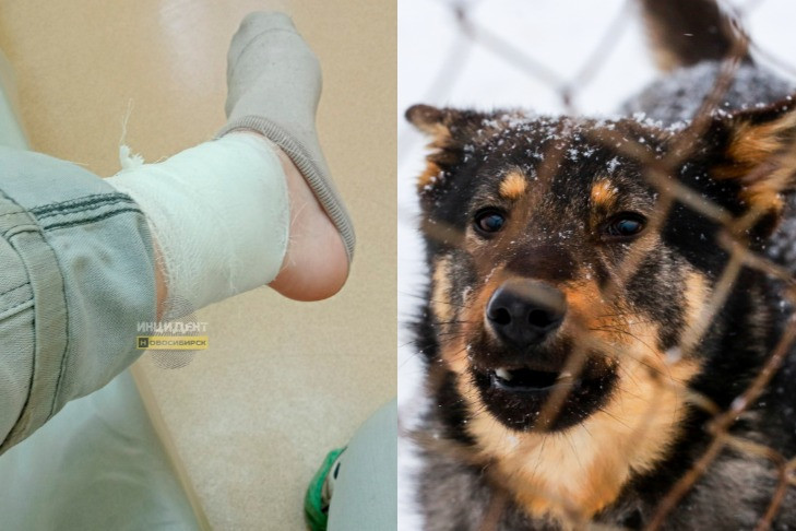 Рабочему собаки прокусили ногу на стройке в Новосибирске