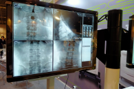 В Новосибирске нейрохирург рассказал, как на самом деле врачи относятся к ИИ