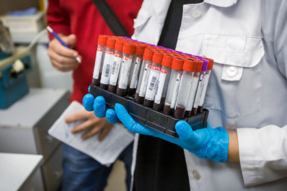 118 млн рублей на системы мониторинга глюкозы для детей получит Новосибирская область