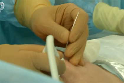 Нерожденных детей оперируют новосибирские хирурги