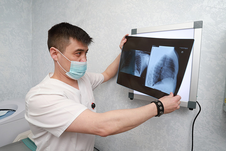 Поликлиники региона приглашают новосибирцев проверить свои легкие в преддверии всемирного дня борьбы против туберкулеза