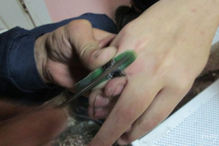 Спасатели болгаркой сняли кольцо с пальца сибирячки
