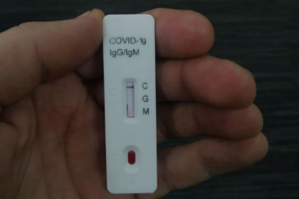 Тесты на антитела к коронавирусу появились в аптеках Новосибирска