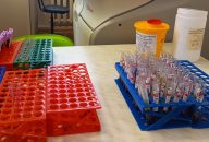 Больше возможностей для лечения пациентов от гепатита С появилось в Новосибирской области