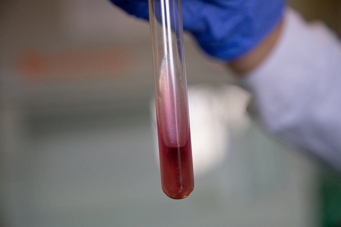 коронавирус анализ крови