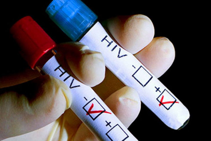Стартовала декада бесплатного тестирования на ВИЧ